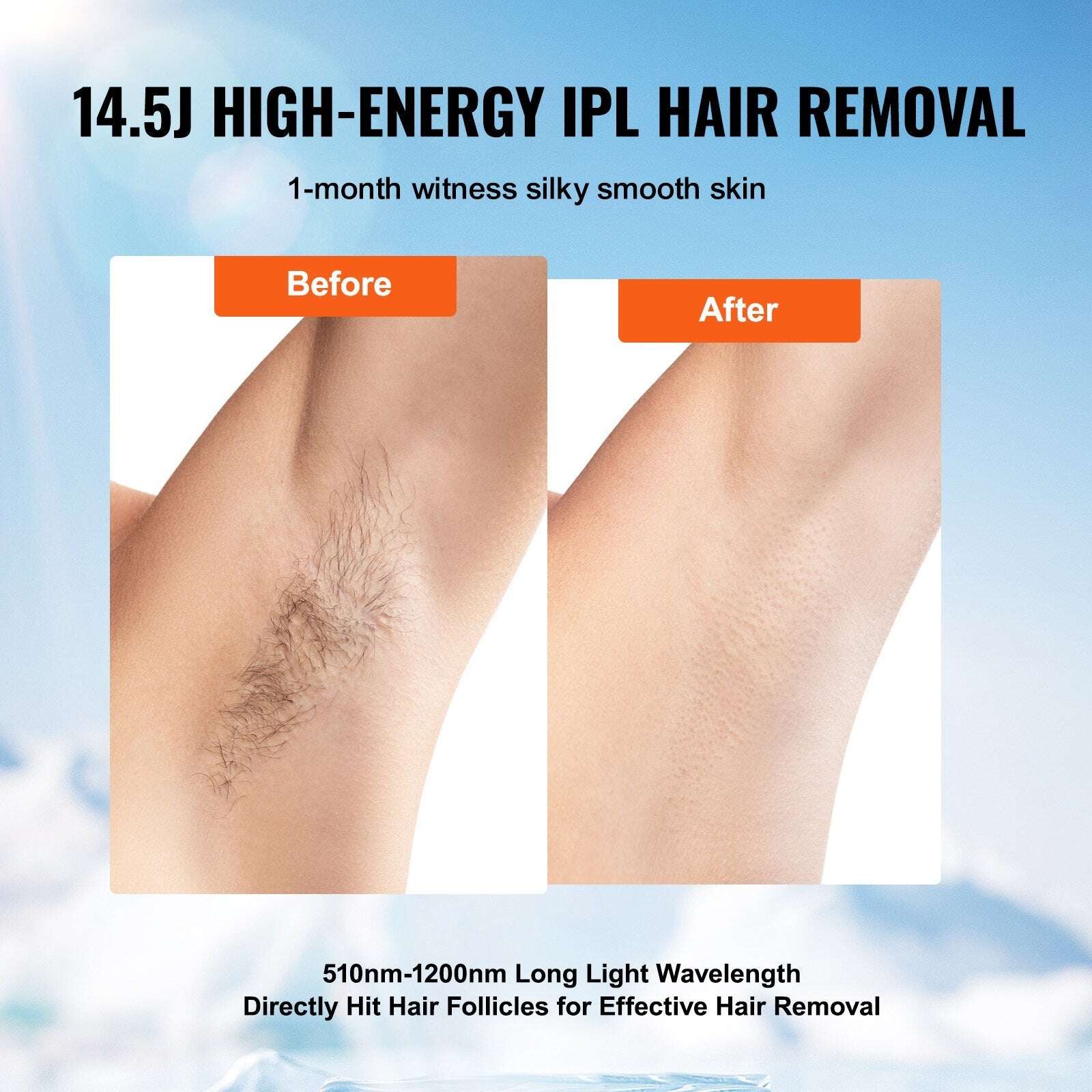 Before and after comparison of IPL hair reduction on a leg with text about high-energy IPL technology.