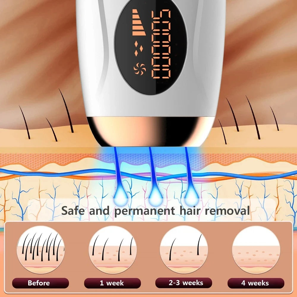 Compact IPL Laser Hair Removal Device – 999,999 Flashes, 5 Energy Levels, Painless Full-Body Treatment