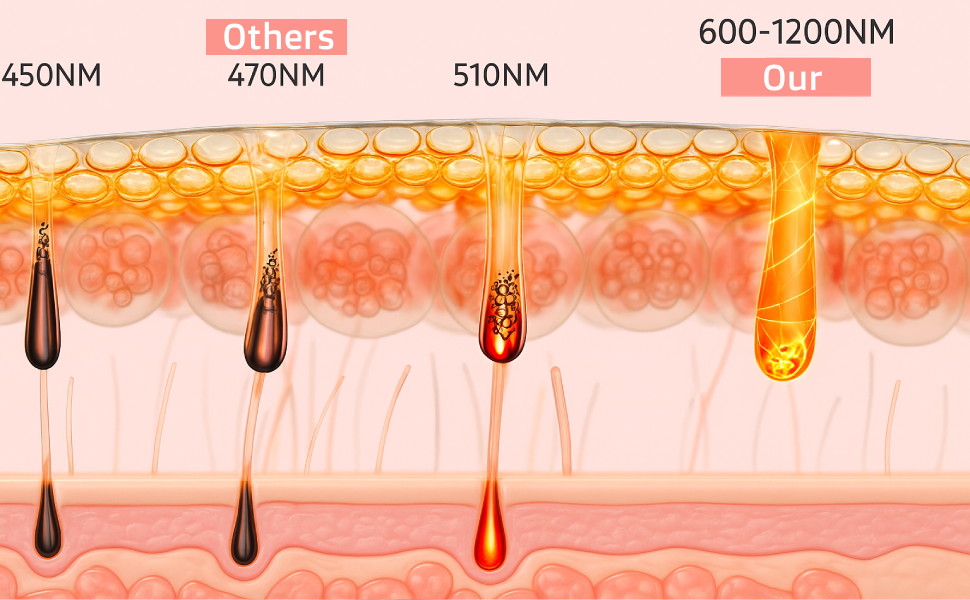 The Ultimate Guide to IPL Hair Removal: What to Expect and How to Use Them SMOOVELUXE™