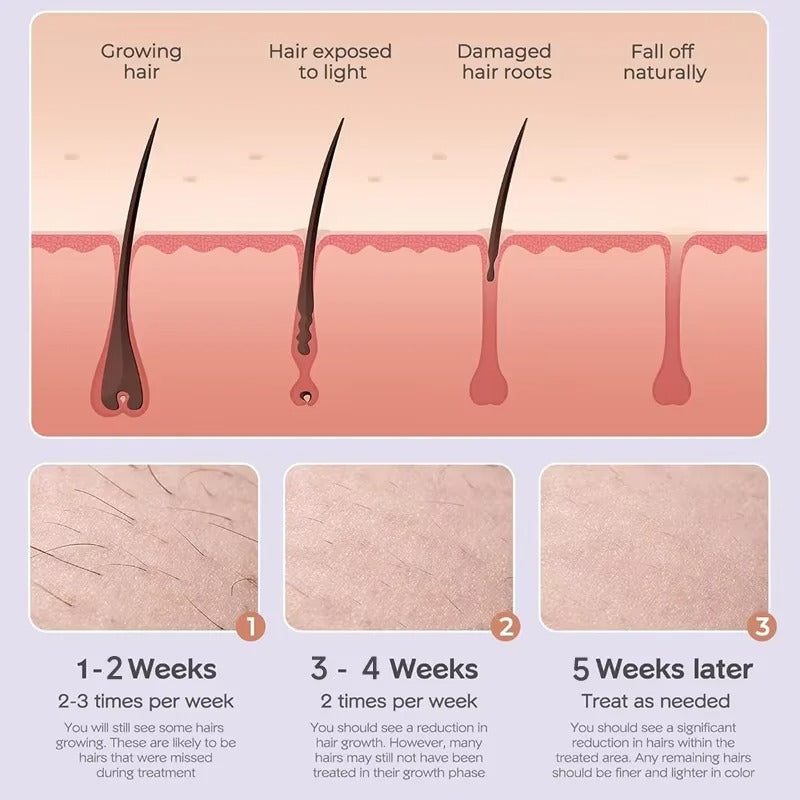 Hair growth and care diagram showing different stages of hair health and IPL treatment effects.
