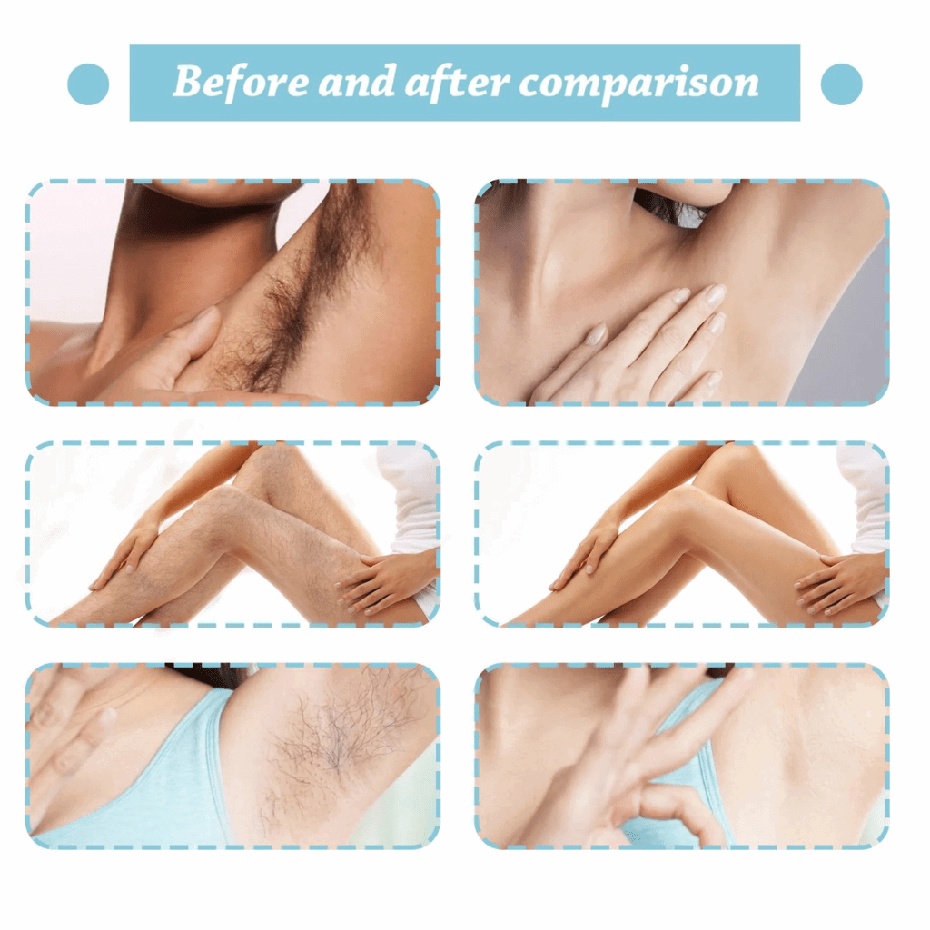 Painless Hair Removal Spray for Women & Men – Fast, Gentle, Plant Extract Formula for Legs, Arms, Underarms & Bikini (80ml) - SMOOVELUXE