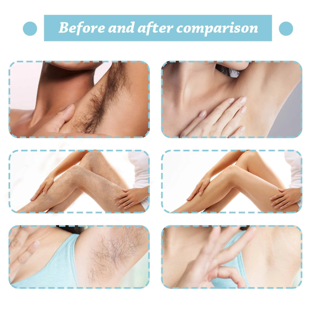 Painless Hair Removal Spray for Women & Men – Fast, Gentle, Plant Extract Formula for Legs, Arms, Underarms & Bikini (80ml)
