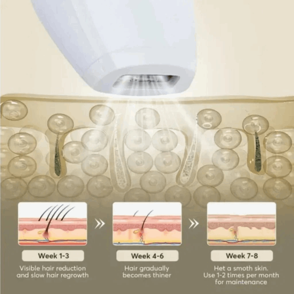 Diagram showing IPL light grooming hair removal device and regrowth process with a close-up of skin texture.