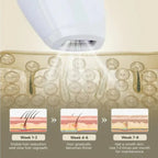 Luxe IPL Laser Hair Removal Device – 900,000 Flashes | Painless Electric Epilator for Face, Body, Bikini & Legs - SMOOVELUXE