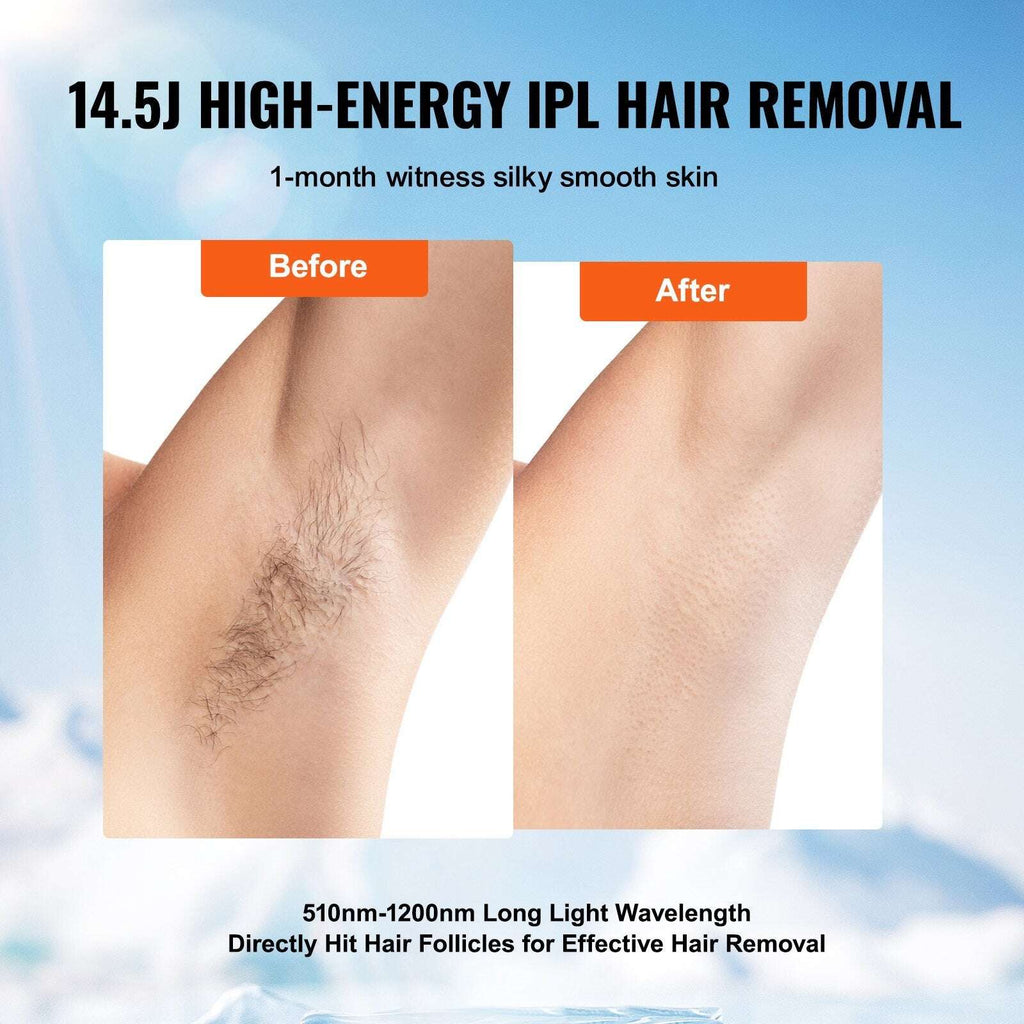 Before and after comparison of IPL hair reduction on a leg with text about high-energy IPL technology.