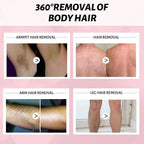Gentle Hair Removal Spray for Women – 100ml Foam Mousse for Legs, Arms, Bikini, Armpits | Painless, Non - Irritating Depilatory Cream - SMOOVELUXE