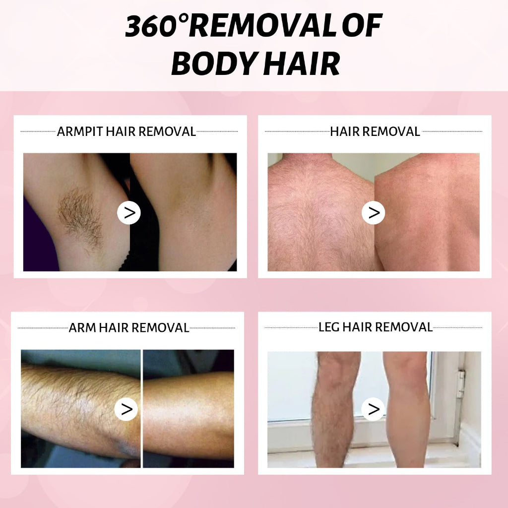 Gentle Hair Removal Spray for Women – 100ml Foam Mousse for Legs, Arms, Bikini, Armpits | Painless, Non-Irritating Depilatory Cream