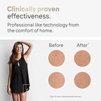 Premium OPT IPL Laser Hair Removal Device | Painless, Medical‑Grade, Touchscreen, Whole Body Hair Reduction - SMOOVELUXE