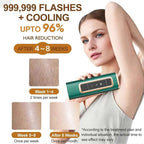 FY‑507AG Professional IPL Hair Removal Device with Ice‑Cooling | Painless, Permanent Hair Reduction System for Smooth Skin - SMOOVELUXE