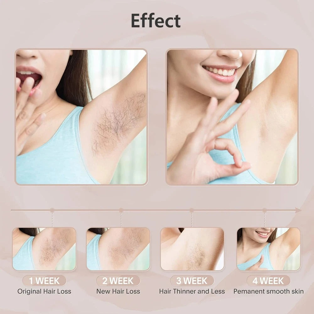 Compact IPL Laser Hair Removal Device – 999,999 Flashes, 5 Energy Levels, Painless Full-Body Treatment