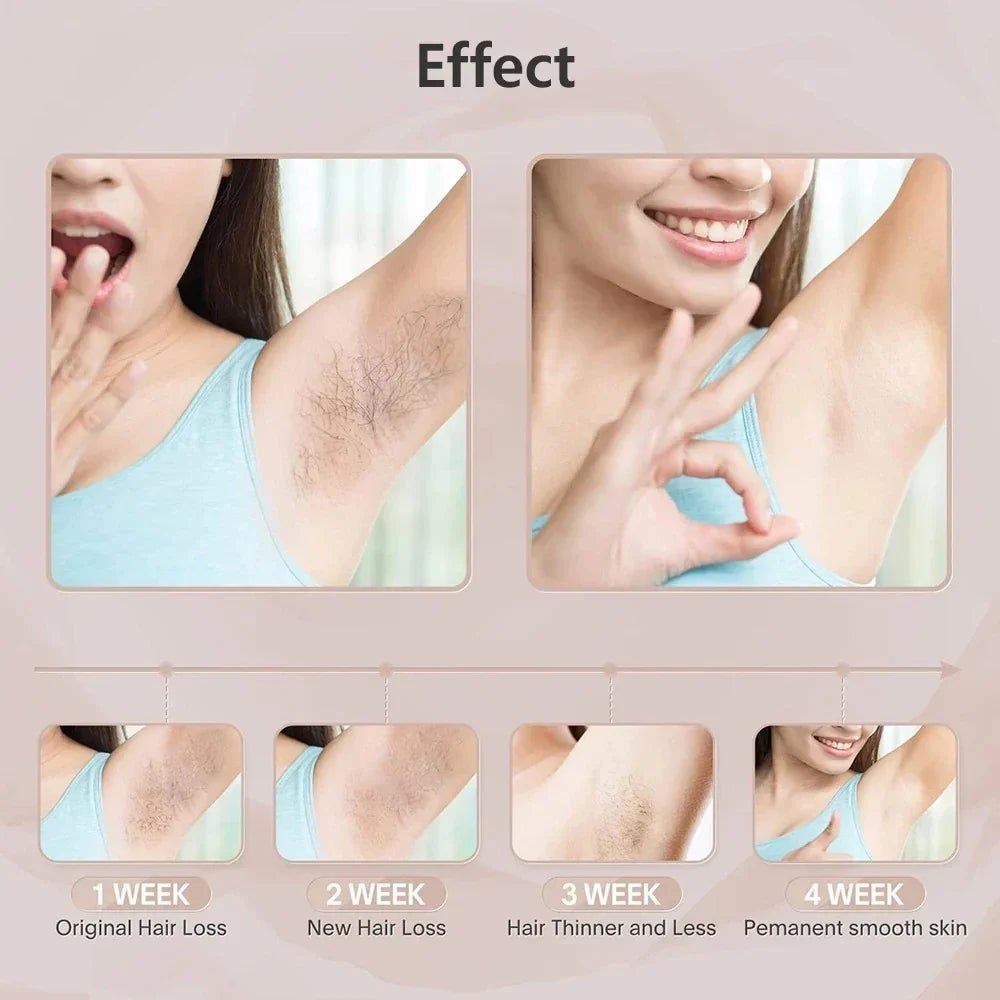 Compact IPL Laser Hair Removal Device – 999,999 Flashes, 5 Energy Levels, Painless Full - Body Treatment - SMOOVELUXE